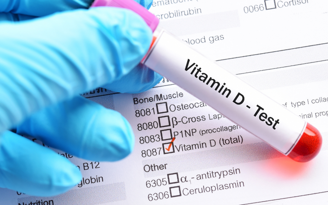 The Link Between Vertigo and Vitamin D