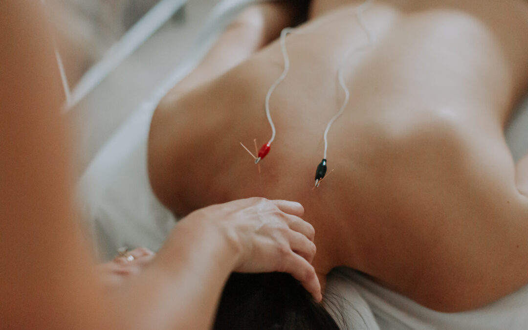 Using Neurofunctional Acupuncture as a Registered Massage Therapist in Ontario